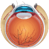  Lasik Eye Surgery mumbai